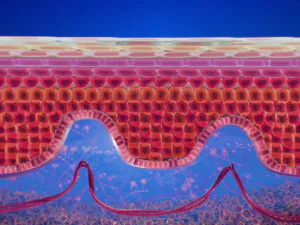 Psirosis Medical Animation 02 by Spark VFX Studios